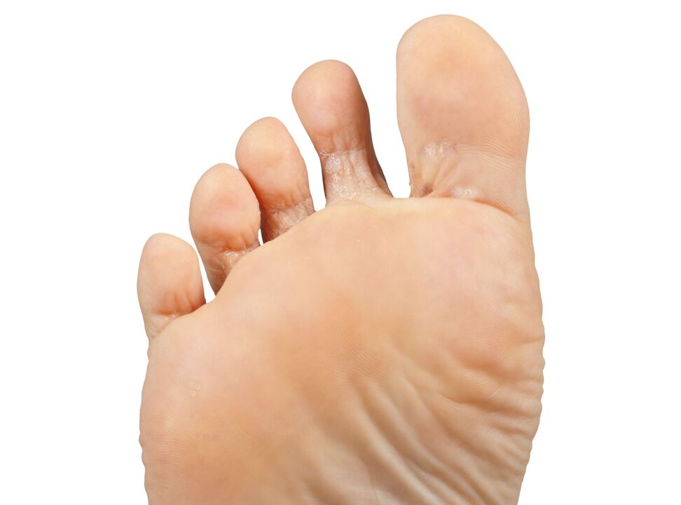 Funger-bom and stop and hypatic-crime-demixil