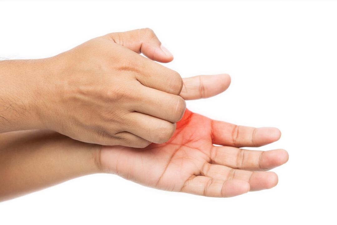 Itching with fungus and its treatment with desmyxil cream